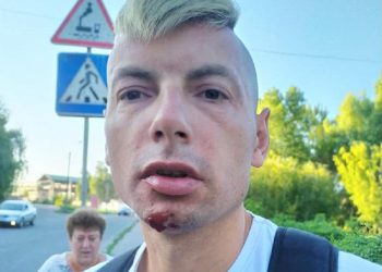 У Чернігові до струсу мозку побили блогера та журналіста Игоря Стаха