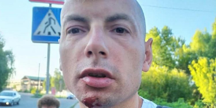 У Чернігові до струсу мозку побили блогера та журналіста Игоря Стаха