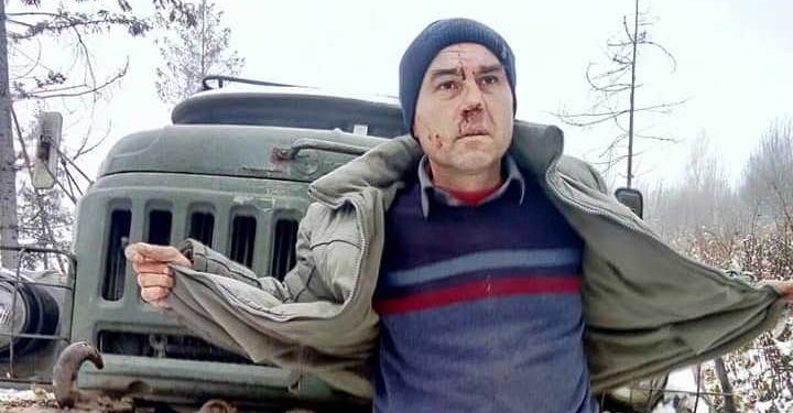 Жорстоке побиття активіста і журналіста на Львівщині
