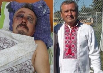 На Донеччині жорстко побили головного редактора місцевої газети