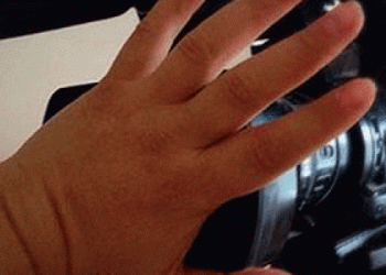 У Львові на комунальному підприємстві пошкодили камеру жірналістам