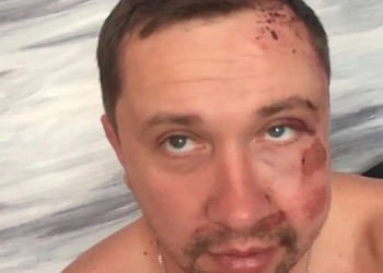 «Нападники діяли за вказівкою»: у Житомирі побили видавця газети, яка відома резонансними публікаціями (оновлено)