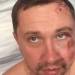 «Нападники діяли за вказівкою»: у Житомирі побили видавця газети, яка відома резонансними публікаціями (оновлено)